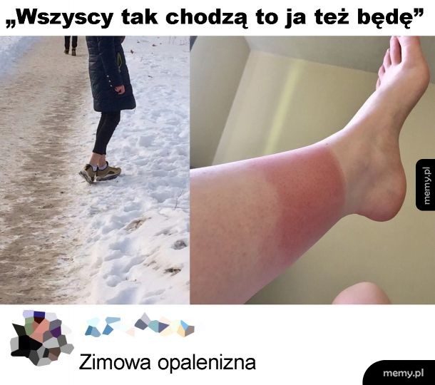 Zimowa opalenizna