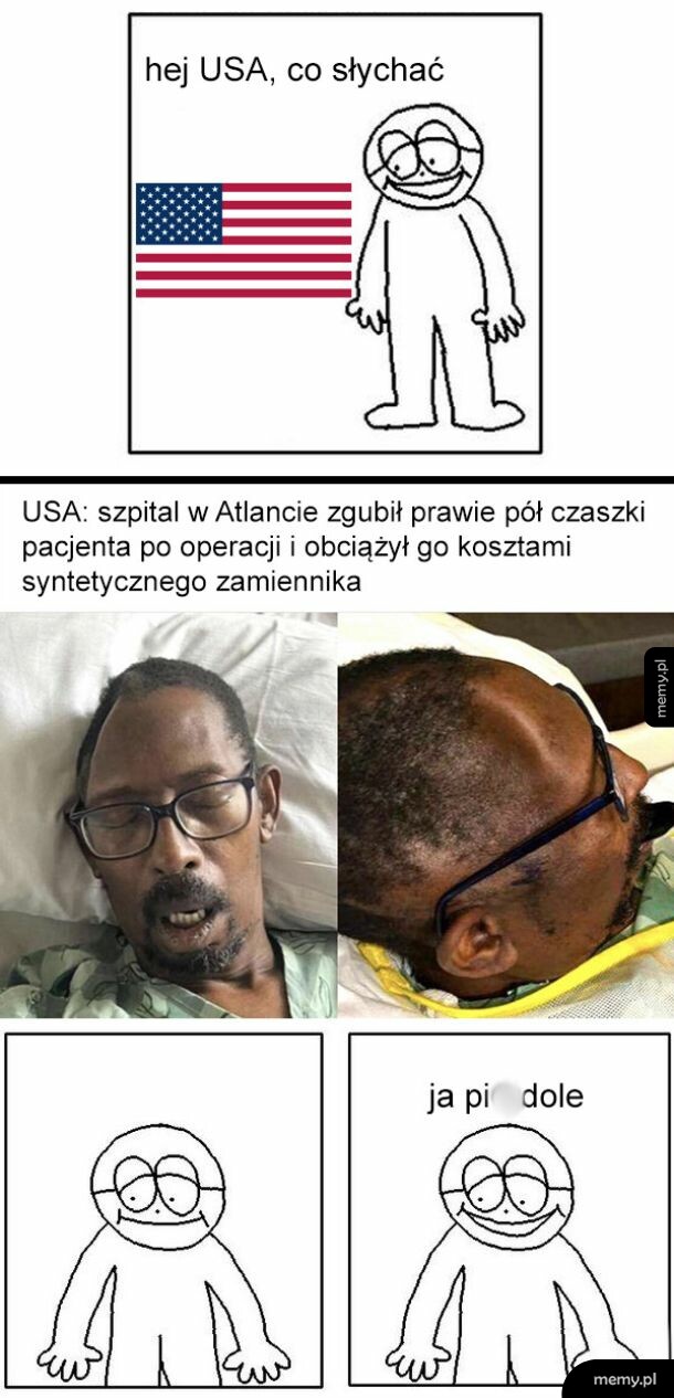 Mem z postacią pytającą USA o wieści i zdjęciem pacjenta z wgniecioną głową