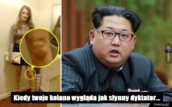 Kolano jak Kim